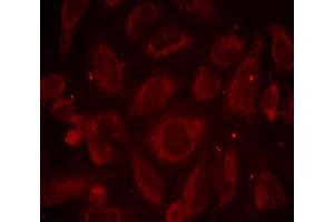 Immunofluorescence staining of methanol-fixed HeLa cells using NF-κB p65 (phospho-Ser468) antibody (E011013, Red) (NF-kB p65 antibody  (pSer468))