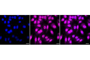 Immunocytochemical staining of HepG2 cells with ELAVL1 antibody (ABIN7798430), 1:1,000).