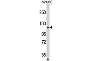 Western blot analysis of HMHA1 Antibody (Center) in A2058 cell line lysates (35ug/lane). (HMHA1 antibody  (Middle Region))