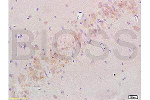 Formalin-fixed and paraffin embedded: rat brain tissue labeled with Anti-Nogo-A Polyclonal Antibody (ABIN725480), Unconjugated at 1:200 followed by conjugation to the secondary antibody and DAB staining (Reticulon 4 antibody  (AA 301-400))