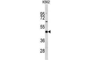 Western blot analysis of EIF4A2 Antibody (C-term) in K562 cell line lysates (35µg/lane).