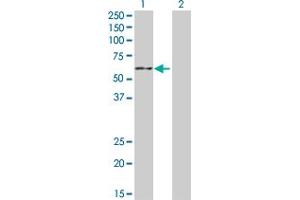 Western Blot analysis of CYP19A1 expression in transfected 293T cell line by CYP19A1 MaxPab polyclonal antibody. (Aromatase antibody  (AA 1-503))