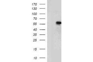 HEK293T cells were transfected with the pCMV6-ENTRY control (Left lane) or pCMV6-ENTRY TP53 (Right lane) cDNA for 48 hrs and lysed. (p53 antibody)