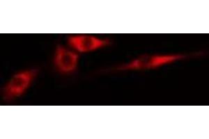 ABIN6274981 staining Hela cells by IF/ICC. (CDC42EP4 antibody  (Internal Region))