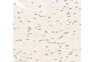 Immunohistochemistry of paraffin embedded mouse heart using SUPT3H (ABIN7075767) at dilution of 1: 1500 (400x lens) (SUPT3H/SPT3 antibody)