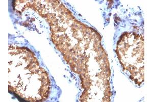 Formalin-fixed, paraffin-embedded human Testis stained with VCL Mouse Monoclonal Antibody (VCL/2572). (Vinculin antibody  (AA 174-322))