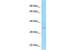 Image no. 1 for anti-Regulation of Nuclear Pre-mRNA Domain Containing 1A (RPRD1A) (AA 79-128) antibody (ABIN6748172) (RPRD1A antibody  (AA 79-128))