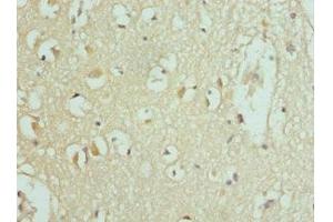 Immunohistochemistry of paraffin-embedded human brain tissue using ABIN7159841 at dilution of 1:100 (SLC25A2 antibody  (AA 1-301))