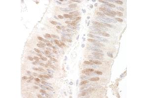 Immunohistochemistry (IHC) image for anti-Methyl-CpG Binding Domain Protein 3 (MBD3) (AA 265-291) antibody (ABIN7448643)