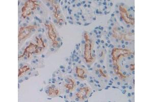 #VALUE! (SIRPA antibody  (AA 56-296))