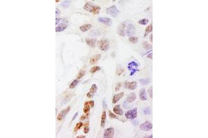 anti-DEAH (Asp-Glu-Ala-His) Box Polypeptide 38 (DHX38) (AA 1150-1200) antibody