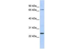 Image no. 1 for anti-Zinc Finger Protein 835 (ZNF835) (AA 306-355) antibody (ABIN6742669) (ZNF835 antibody  (AA 306-355))
