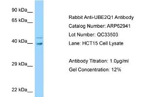 Western Blotting (WB) image for anti-Ubiquitin-Conjugating Enzyme E2Q Family Member 1 (UBE2Q1) (Middle Region) antibody (ABIN2789307) (UBE2Q1 antibody  (Middle Region))