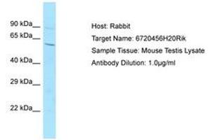 Image no. 1 for anti-Chromosome 14 Open Reading Frame 101 (C14orf101) (AA 201-250) antibody (ABIN6749829) (C14orf101 antibody  (AA 201-250))