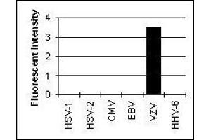 Cross Reactivity Results determined by IFA (Glycoprotein I antibody)