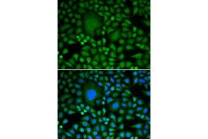 Immunofluorescence analysis of HeLa cells using DDX5 antibody. (DDX5 antibody  (AA 1-614))