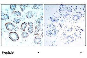 Image no. 1 for anti-BCL2-Like 11 (Apoptosis Facilitator) (BCL2L11) (Ser65) antibody (ABIN197552) (BIM antibody  (Ser65))