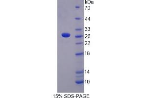 Image no. 1 for C-Reactive Protein (CRP) (AA 20-227) protein (His tag) (ABIN6237699) (CRP Protein (AA 20-227) (His tag))