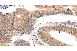 SEMA3G antibody