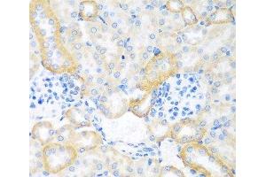 Immunohistochemistry of paraffin-embedded Mouse kidney using CEACAM7 Polyclonal Antibody at dilution of 1:100 (40x lens). (CEACAM7 antibody)