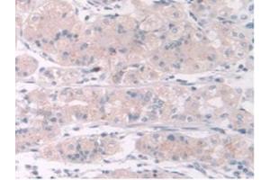 IHC-P analysis of Human Stomach Tissue, with DAB staining. (TPMT antibody  (AA 26-227))