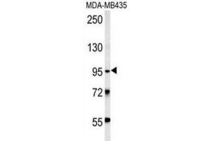 Western Blotting (WB) image for anti-Thyrotropin Releasing Hormone Degrading Enzyme (TRHDE) antibody (ABIN3002402)