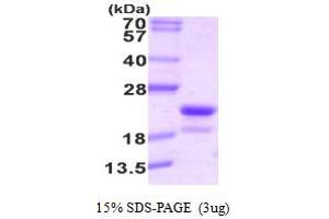 SDS-PAGE (SDS) image for Riboflavin Kinase (RFK) (AA 1-162) protein (His tag) (ABIN667744) (Riboflavin Kinase Protein (RFK) (AA 1-162) (His tag))