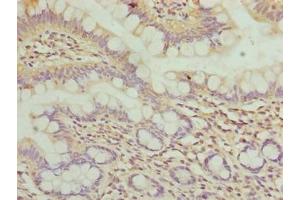 Immunohistochemistry of paraffin-embedded human small intestine tissue using ABIN7175786 at dilution of 1:100 (WDR66 antibody  (AA 1-1154))
