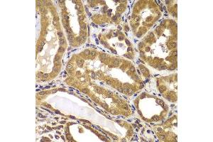 Immunohistochemistry of paraffin-embedded human kidney using PSEN2 antibody. (Presenilin 2 antibody)