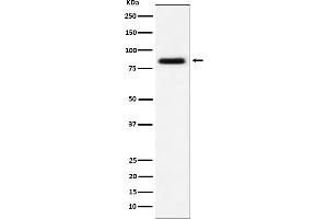Western Blotting (WB) image for anti-Endoglin (ENG) antibody (ABIN7607032)