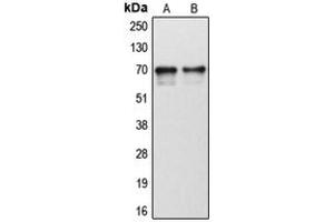 Western blot analysis of Cytochrome P450 1B1 expression in human tonsil (A), human liver (B) whole cell lysates. (CYP1B1 antibody  (Center))