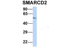 Host:  Rabbit  Target Name:  SMARCD2  Sample Type:  Human Fetal Heart  Antibody Dilution:  1. (SMARCD2 antibody  (Middle Region))