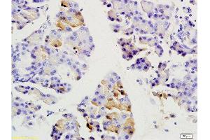 Formalin-fixed and paraffin embedded rat pancreas labeled with Anti-SGCB/SGC Polyclonal Antibody, Unconjugated  at 1:200 followed by conjugation to the secondary antibody and DAB staining. (SGCB antibody  (AA 165-260))