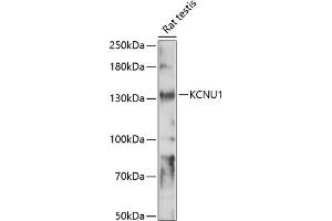 Western blot analysis of extracts of rat testis, using KCNU1 antibody (ABIN7269471) at 1:1000 dilution. (KCNU1 antibody  (AA 920-1149))