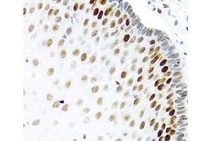 Immunohistochemistry (Paraffin-embedded Sections) (IHC (p)) image for anti-KH Domain Containing, RNA Binding, Signal Transduction Associated 2 (KHDRBS2) antibody (ABIN7261954)