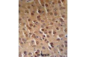 Immunohistochemistry (IHC) image for anti-Cyclin-Dependent Kinase 14 (CDK14) antibody (ABIN3002794) (CDK14 antibody)