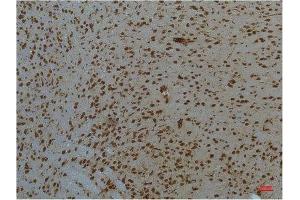 Immunohistochemistry (IHC) analysis of paraffin-embedded Mouse Brain Tissue using STAT3 Mouse Monoclonal Antibody diluted at 1:200.