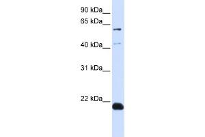 WB Suggested Anti-C14orf180 Antibody Titration:  0. (C14orf180 antibody  (N-Term))