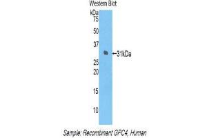 Western Blotting (WB) image for anti-Glypican 4 (GPC4) (AA 261-527) antibody (ABIN1859055) (GPC4 antibody  (AA 261-527))