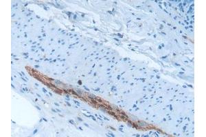 Used in DAB staining on fromalin fixed paraffin- embedded brain tissue (S100B antibody  (AA 1-92))