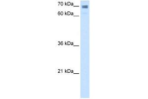 WB Suggested Anti-CLGN Antibody Titration:  2. (Calmegin antibody  (N-Term))