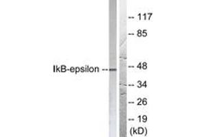 Western Blotting (WB) image for anti-Nuclear Factor of kappa Light Polypeptide Gene Enhancer in B-Cells Inhibitor, epsilon (NFKBIE) (AA 131-180) antibody (ABIN2888569) (NFKBIE antibody  (AA 131-180))