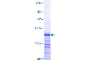 SMARCB1 Protein (AA 81-180) (GST tag)