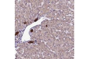 Immunohistochemical staining of human liver with RPS26 polyclonal antibody  shows strong cytoplasmic positivity in bile duct cells at 1:20-1:50 dilution.