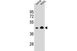 Western Blotting (WB) image for anti-Olfactory Receptor, Family 10, Subfamily A, Member 4 (OR10A4) antibody (ABIN2995885)