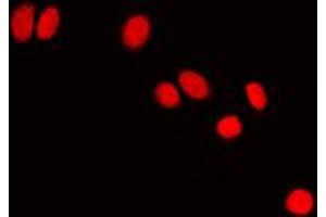 Immunofluorescent analysis of HP1 alpha staining in NIH3T3 cells. (CBX5 antibody  (Center))
