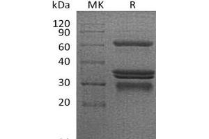 Western Blotting (WB) image for CD40 (CD40) protein (Fc Tag) (ABIN7320972) (CD40 Protein (CD40) (Fc Tag))