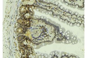 ABIN6269060 at 1/100 staining Mouse colon tissue by IHC-P. (JAK2 antibody  (C-Term))