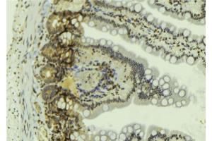 ABIN6269060 at 1/100 staining Mouse colon tissue by IHC-P. (JAK2 antibody  (C-Term))