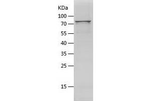 Western Blotting (WB) image for V-Akt Murine Thymoma Viral Oncogene Homolog 1 (AKT1) (AA 1-480) protein (His-IF2DI Tag) (ABIN7285953) (AKT1 Protein (AA 1-480) (His-IF2DI Tag))